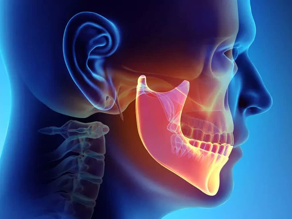 Orthognathic Surgery